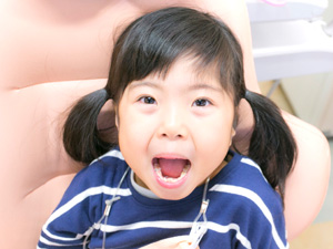 子どものむし歯とその影響
