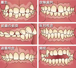 歯 列 咬合 と は